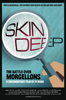 Skin Deep: The Battle Over Morgellons (2019)